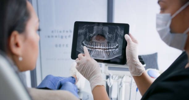 Licensed Tooth Extraction service in Mathews, LA - Smile Center Dentistry